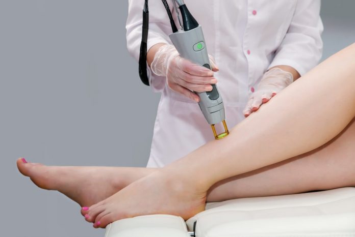 What To Expect From Laser Hair Removal Treatment - A First Timer's Guide